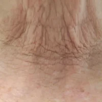 ageing neck